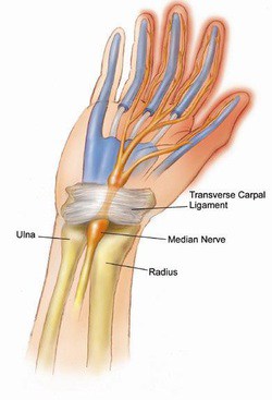 Carpal Wrist